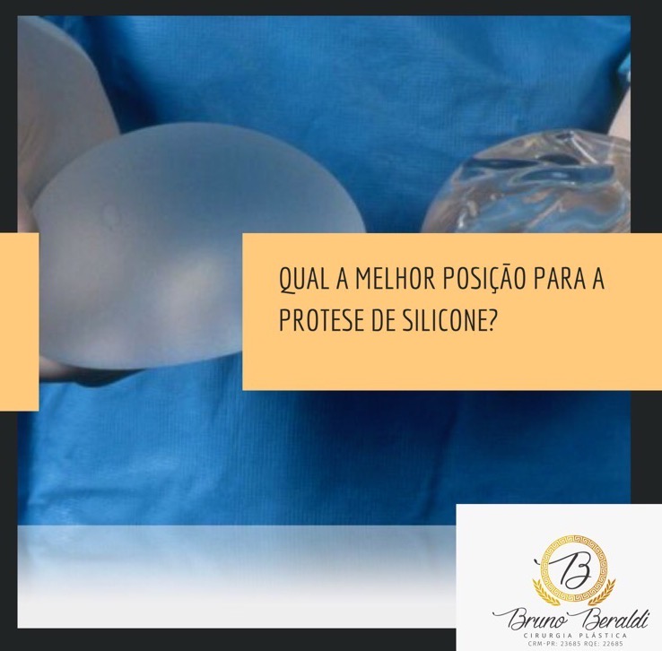 A Prótese de Mama deve ser colocada acima ou abaixo do músculo? Qual a melhor indicação?